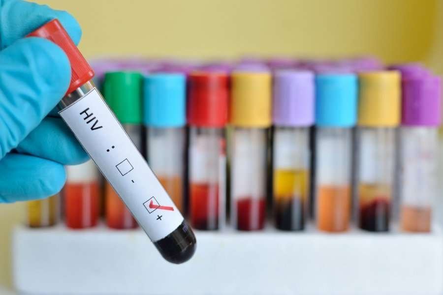 HIV në rritje: 10 raste të reja në pesë muaj